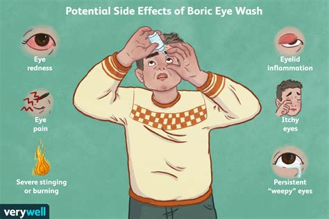 boric acid eye wash for styes
