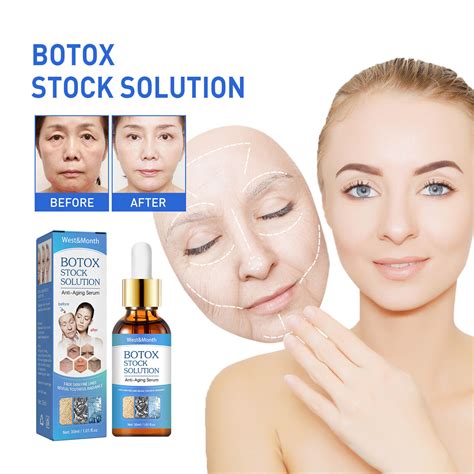 Does Botox Stock Solution Really Work? Find Out The Truth
