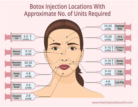 botox injection