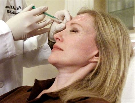 botox injections for multiple sclerosis