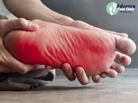 Why Are the Bottom of My Feet Burning? Causes, Symptoms, and Relief Options