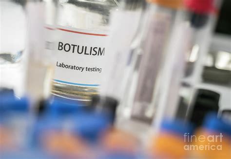botulism laboratory testing