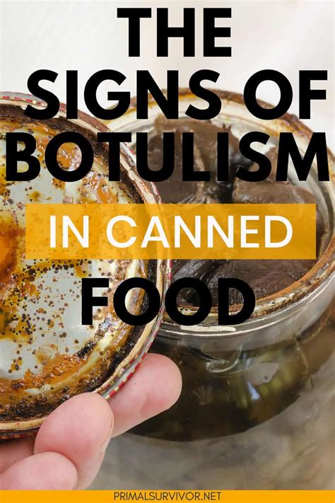 botulism signs in canned food