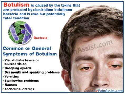 botulism symptoms from botox