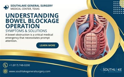Bowel Operation for Blockage: What You Need to Know