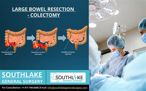 Understanding Bowel Resection Surgery: What You Need to Know About This Life-Changing Procedure