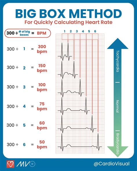 Box Method Ecg
