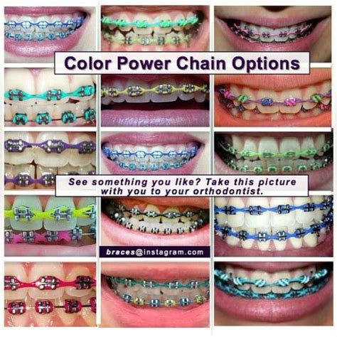 Braces Chain Colors
