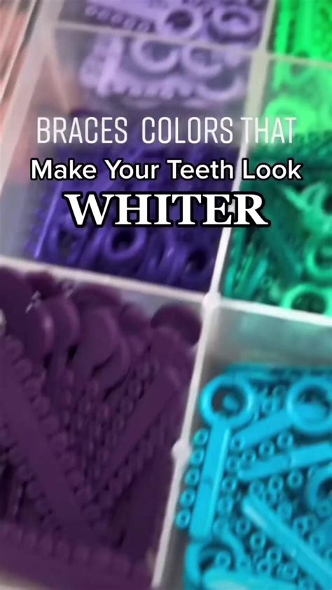 Braces Colors Whiter Teeth