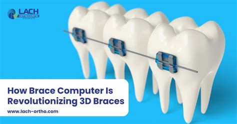 Braces Meaning Computer