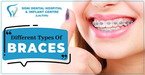 Braces Meaning On