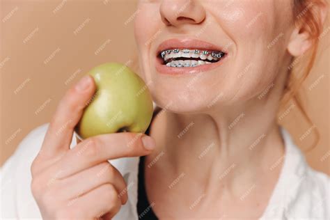 Braces On Teeth Eating