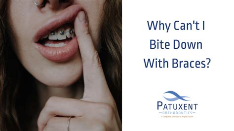 Braces Pain When Biting