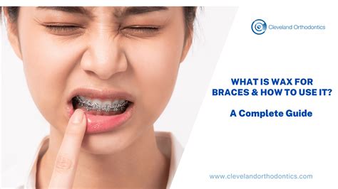 Braces Wax How To