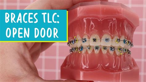 Braces With Doors
