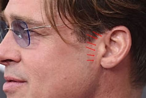 brad pitt facial scars