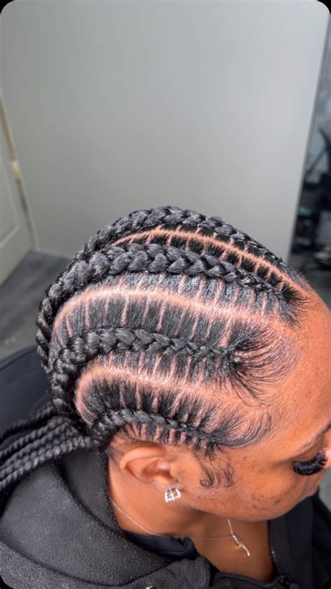 Braids That Won't Pull Edges