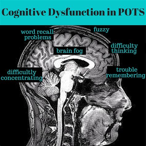 Brain Fog In Pots