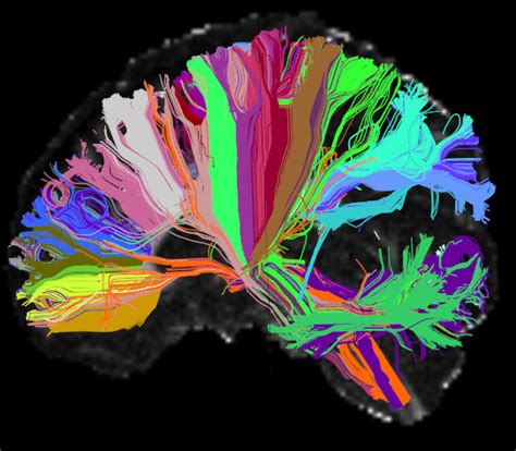 brain initiative cell census network biccn