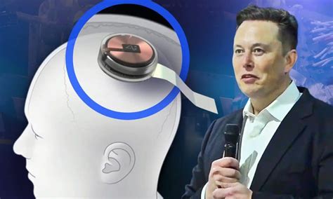 brain interface elon musk