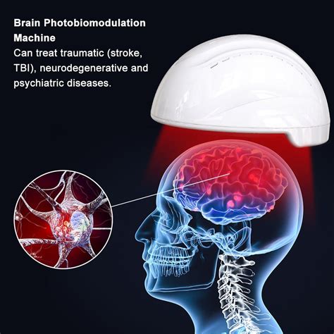 Brain Light Therapy Device