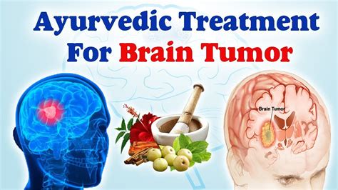brain tumor cure naturally