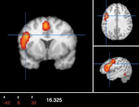 brainmap.org