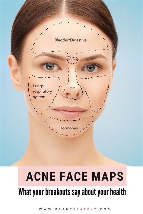 Acne face map Causes of breakouts
