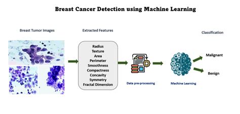 breast cancer dataset python