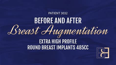 breast implant 485