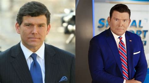 bret baier plastic surgery