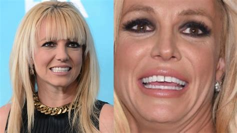 Britney Spears Teeth Transformation: Secrets Revealed!