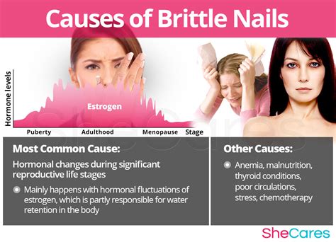 Brittle Nails And Underactive Thyroid
