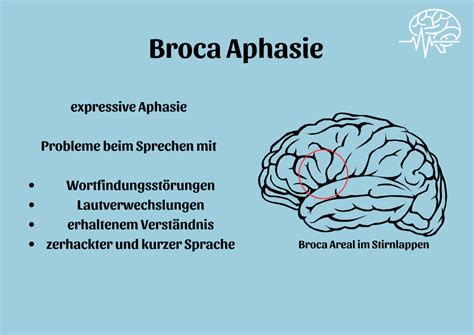 Abbildung 1. Modellvorstellung zur Lokalisation sprachlicher