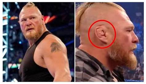 What happened to Brock Lesnar's ear?