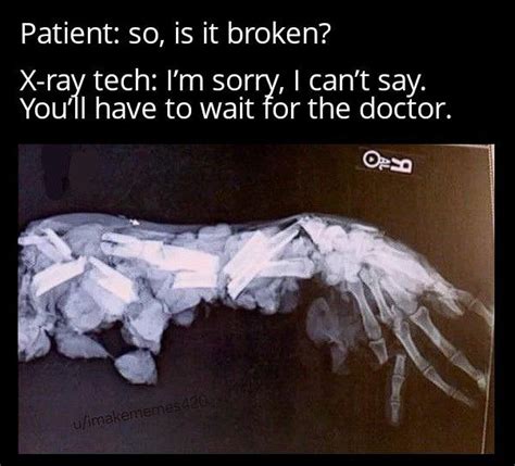 Broken Bone X Ray Meme