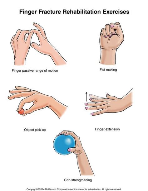 Broken Finger Exercises