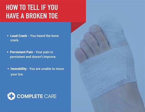 broken toe vs sprained toe