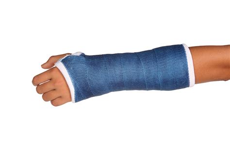 Recovering from a Broken Wrist Cast: What to Expect