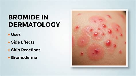 Bromine Negative Effects