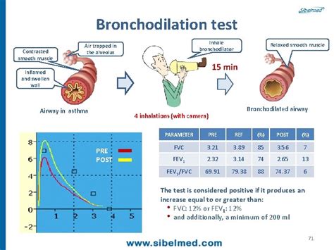 Bronchodilator Test
