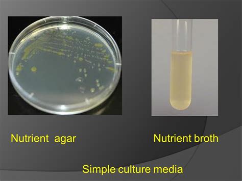Broth Vs Agar Media