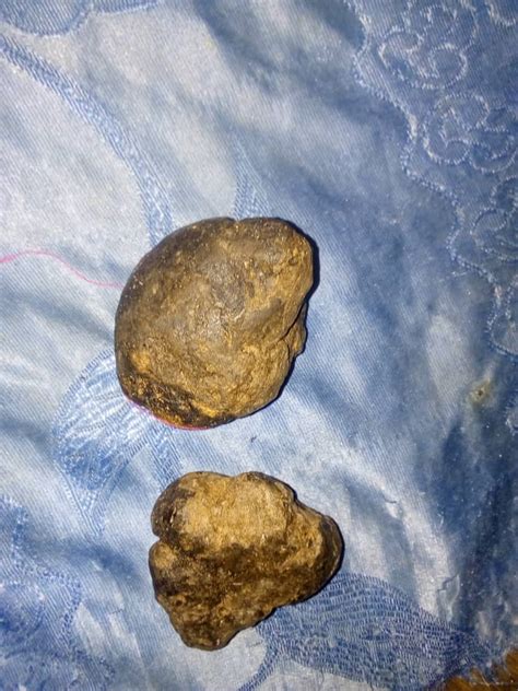 Brown Ambergris Unveiled: Secrets of the Sea's Rare Treasure