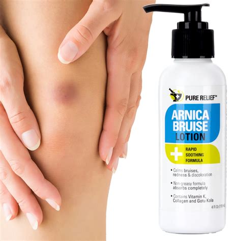 bruise lotion