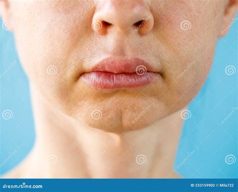 Bruise Under Cheekbone: Causes, Symptoms, and Effective Treatments