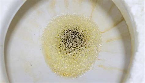 Bubbles In Water When I Pee