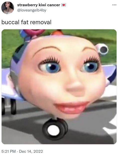 buccal fat removal meme