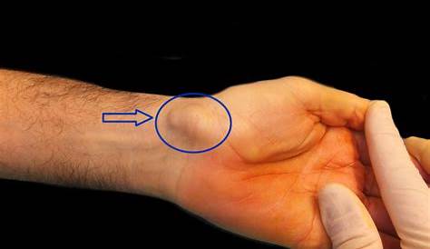 ¿Por qué tenemos líneas en la palma de la mano?