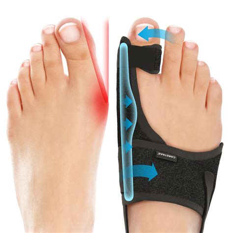 Bunion Splint Instructions