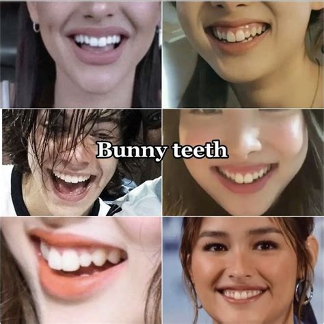 Bunny Teeth Human